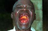ebola mouth